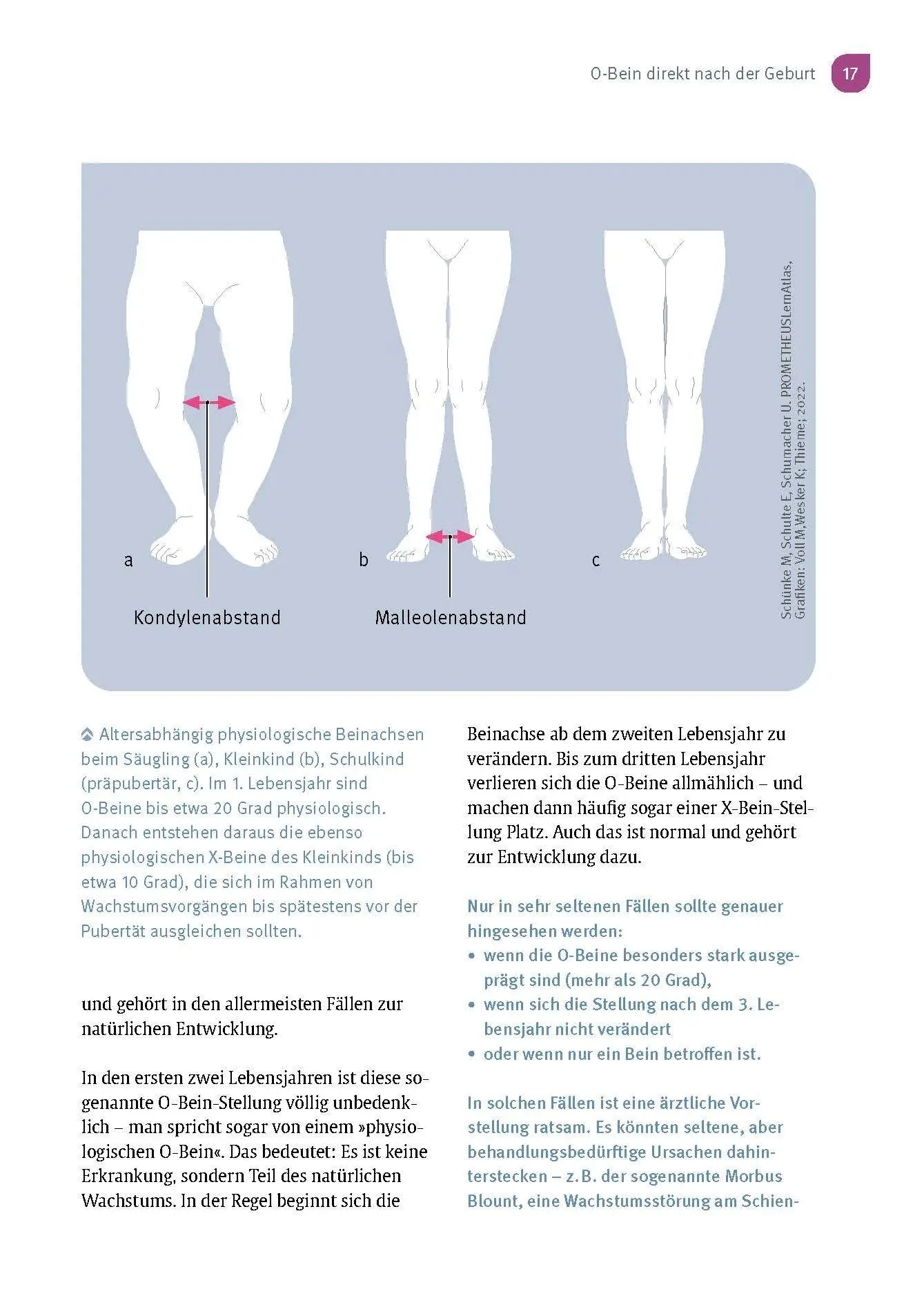 Bild: 9783432120294 | Aus der Praxis eines Kinderorthopäden | Sébastien Hagmann | Buch