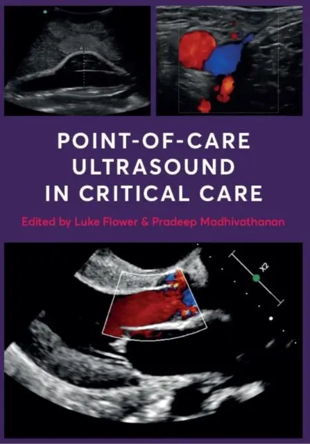 Cover: 9781911510994 | Point-of-Care Ultrasound in Critical Care | Luke Flower (u. a.) | Buch