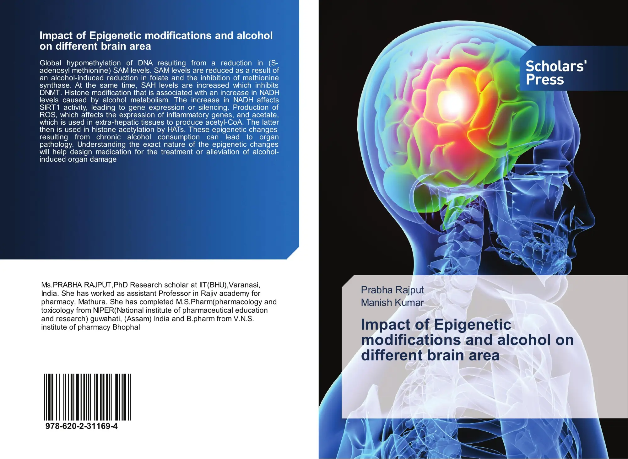 Cover: 9786202311694 | Impact of Epigenetic modifications and alcohol on different brain area