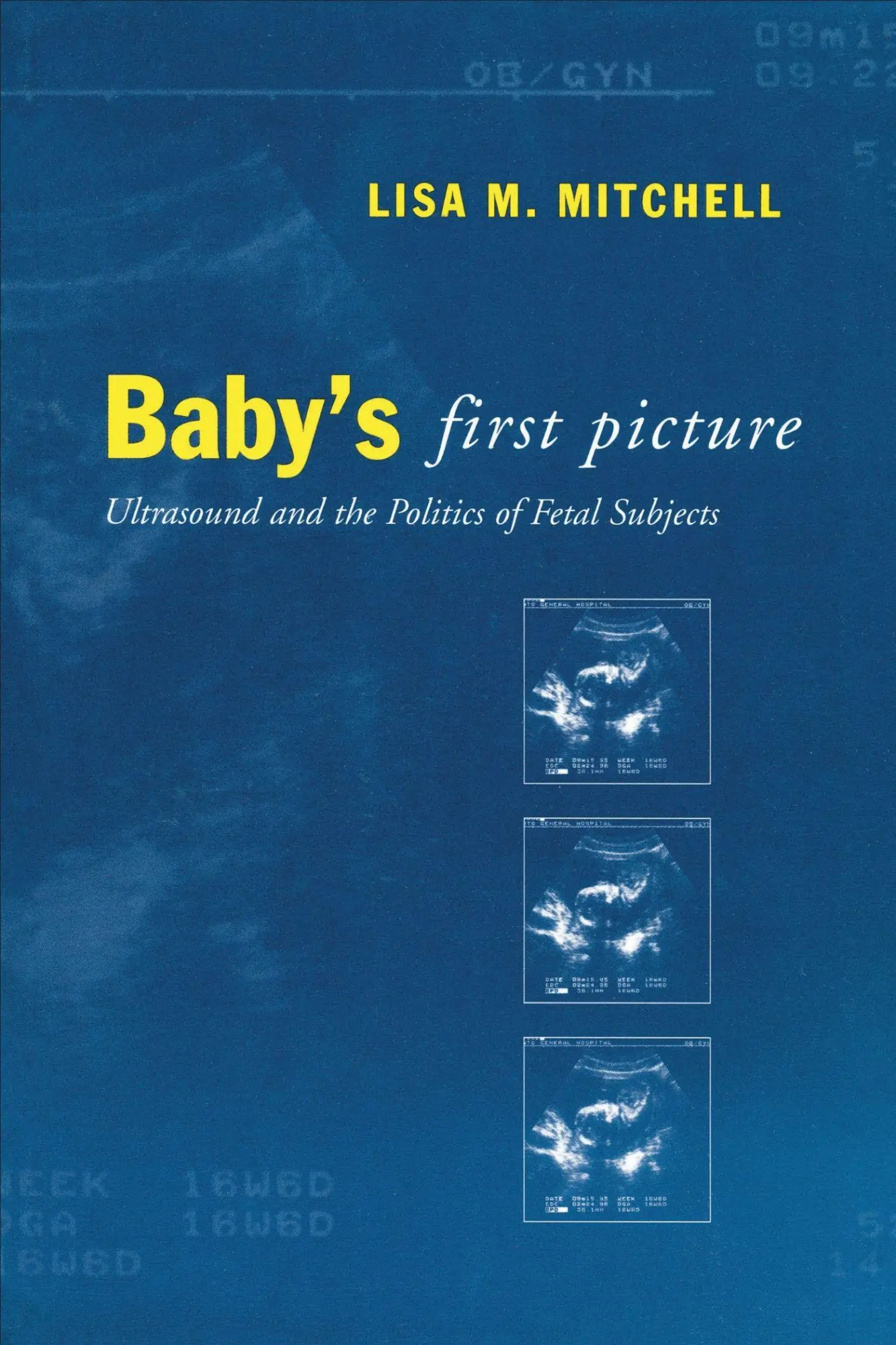 Baby's First Picture
