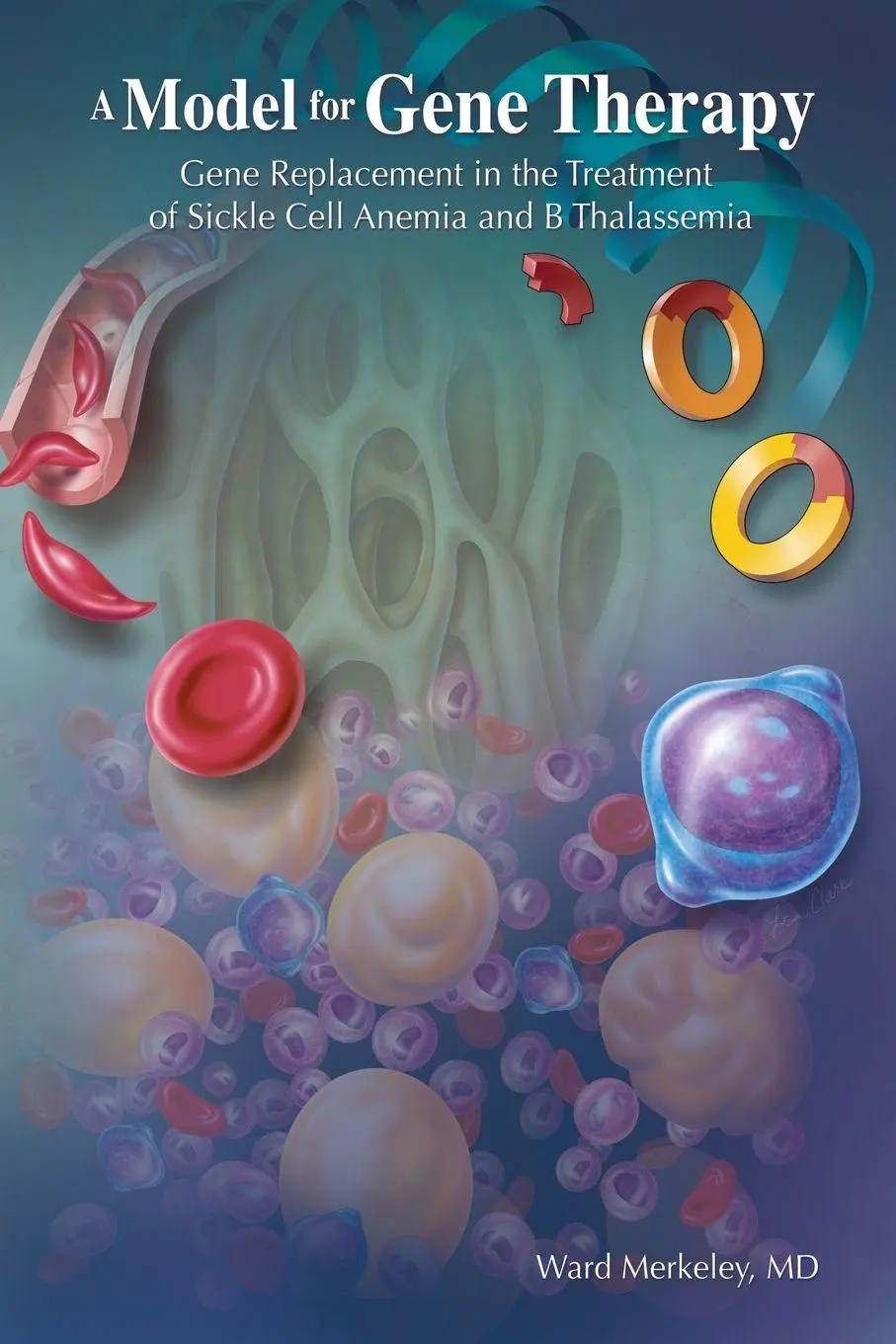 Cover: 9781664136694 | A Model for Gene Therapy | Ward Merkeley M. D. | Taschenbuch | 2021
