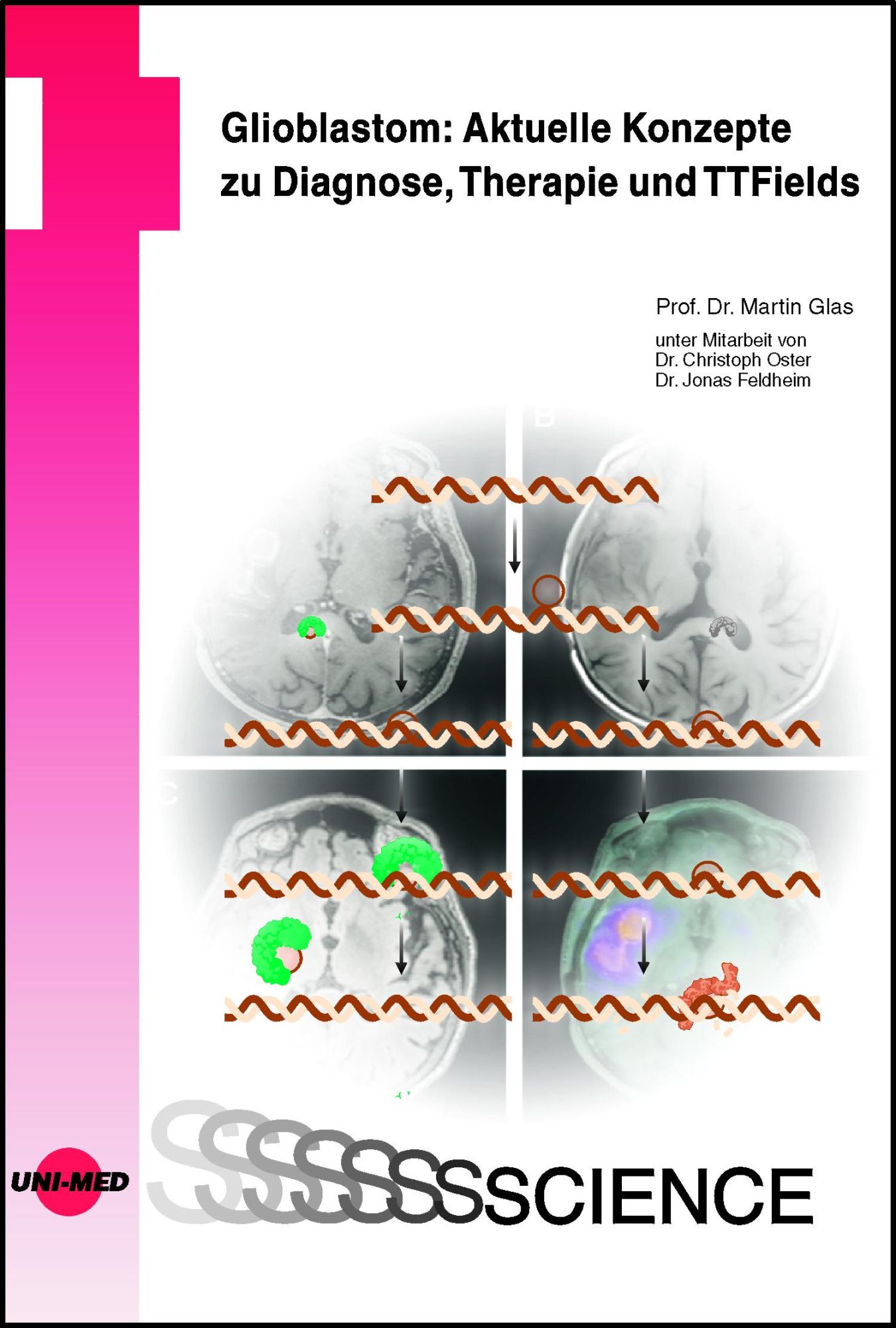 Cover: 9783837416794 | Glioblastom: Aktuelle Konzepte zu Diagnose, Therapie und TTFields