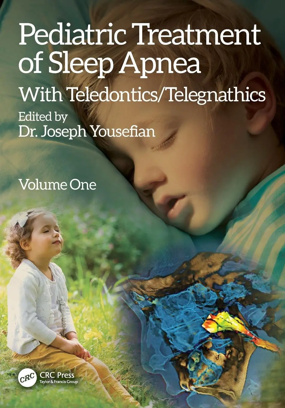Cover: 9781032978994 | Pediatric Treatment of Sleep Apnea | With Teledontics/Telegnathics