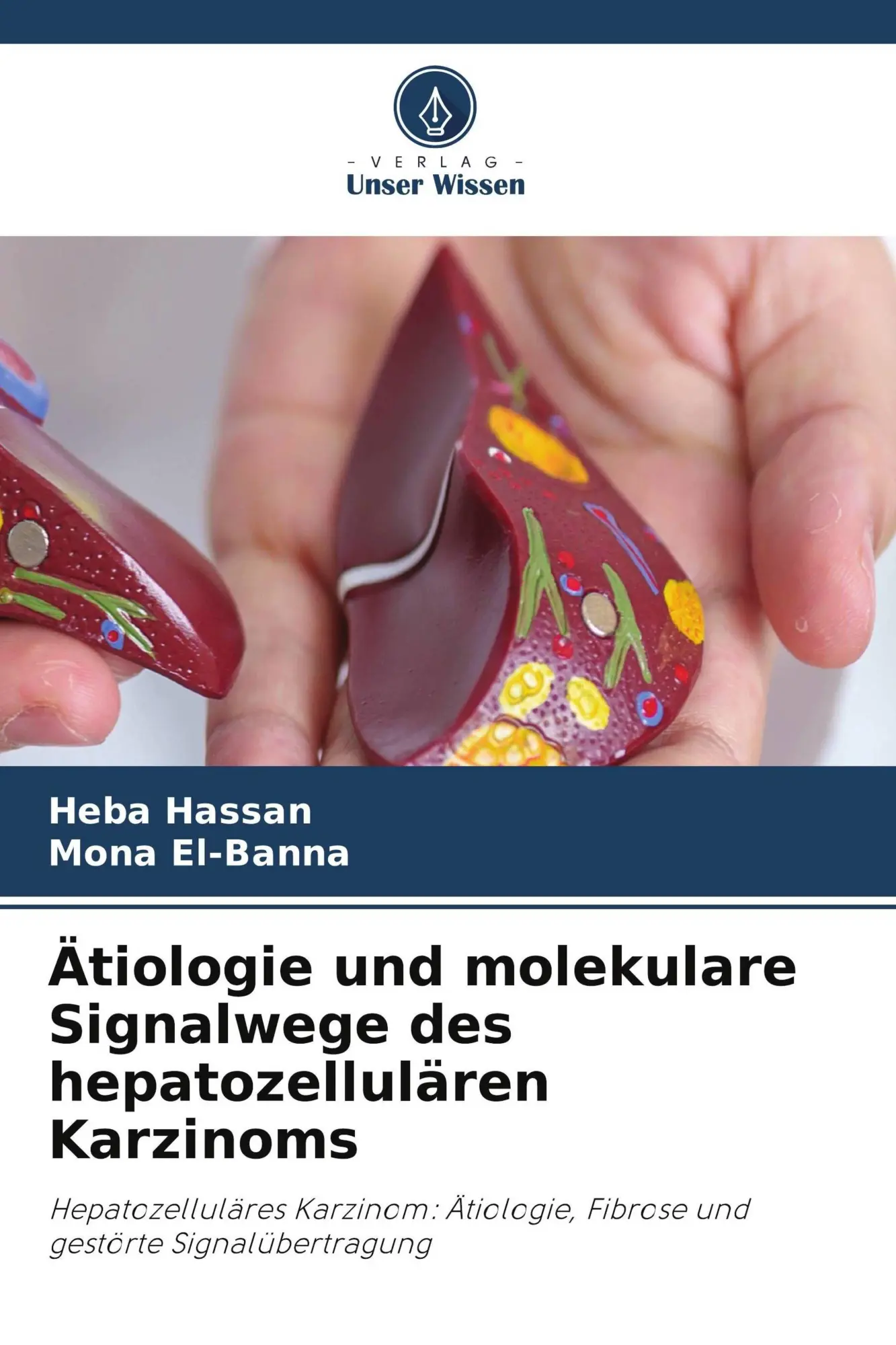 Cover: 9786630251395 | Ätiologie und molekulare Signalwege des hepatozellulären Karzinoms