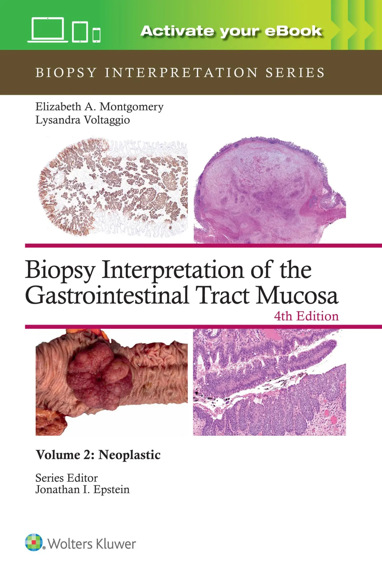 Cover: 9781975213695 | Biopsy Interpretation of the Gastrointestinal Tract Mucosa Volume 2
