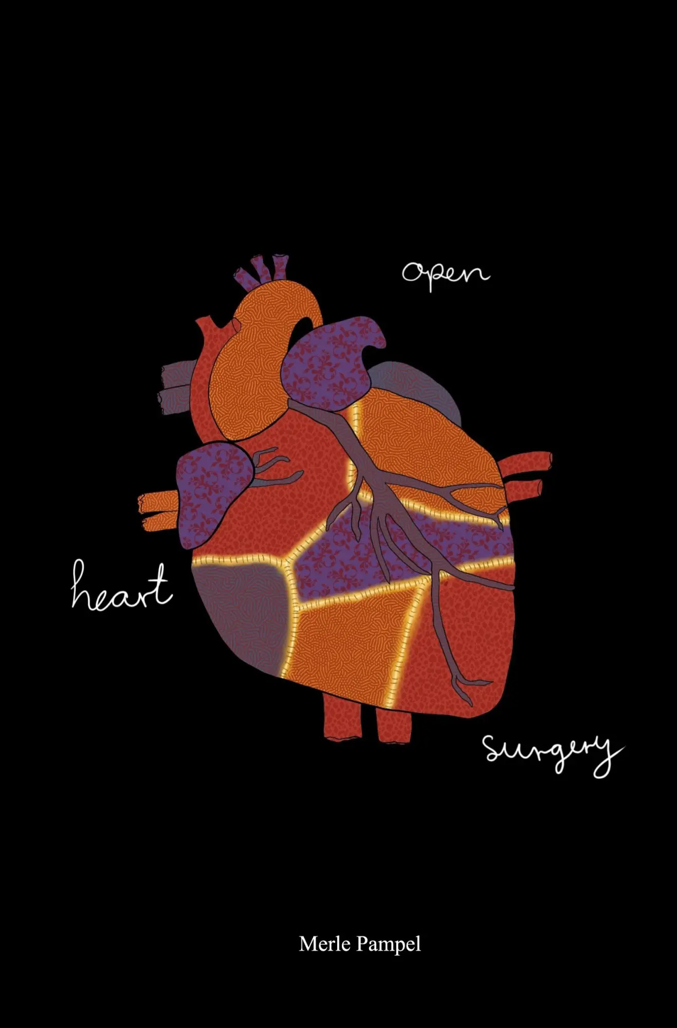 Cover: 9783819414695 | open heart surgery | a collection of poetry | Merle Pampel | Buch