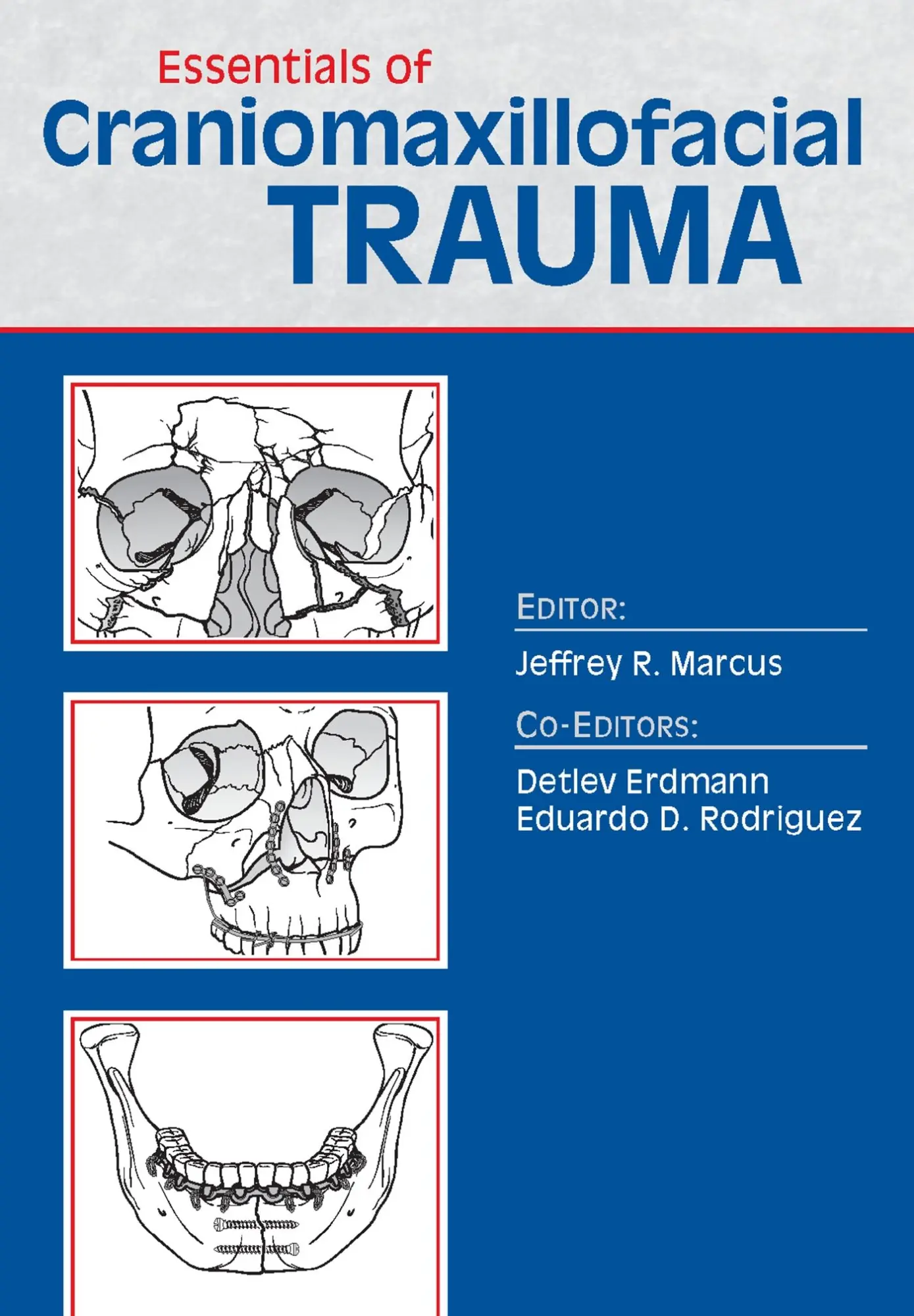 Cover: 9781626235595 | Essentials of Craniomaxillofacial Trauma | Jeffrey Marcus | Buch