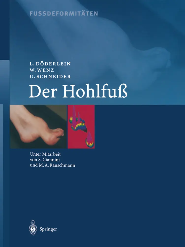 Cover: 9783642630996 | Fussdeformitäten | Der Hohlfuss | L. Döderlein (u. a.) | Taschenbuch