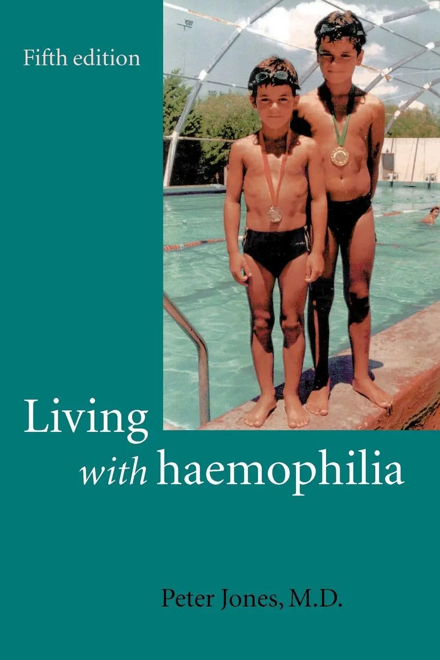 Cover: 9780192632296 | Living with Haemophilia | Peter Jones | Taschenbuch | Englisch | 2002
