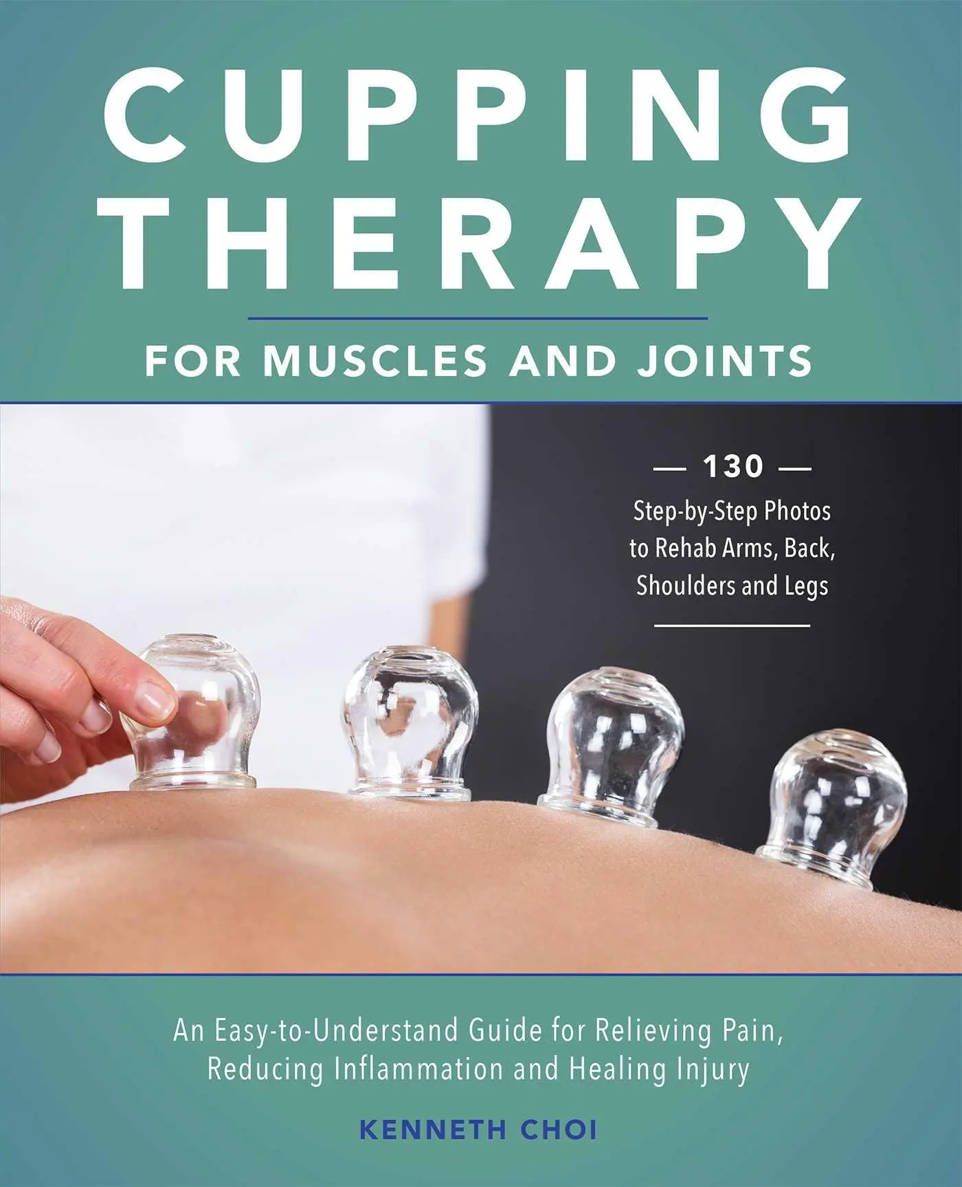 Cover: 9781646042296 | Cupping Therapy for Muscles and Joints | Kenneth Choi | Taschenbuch
