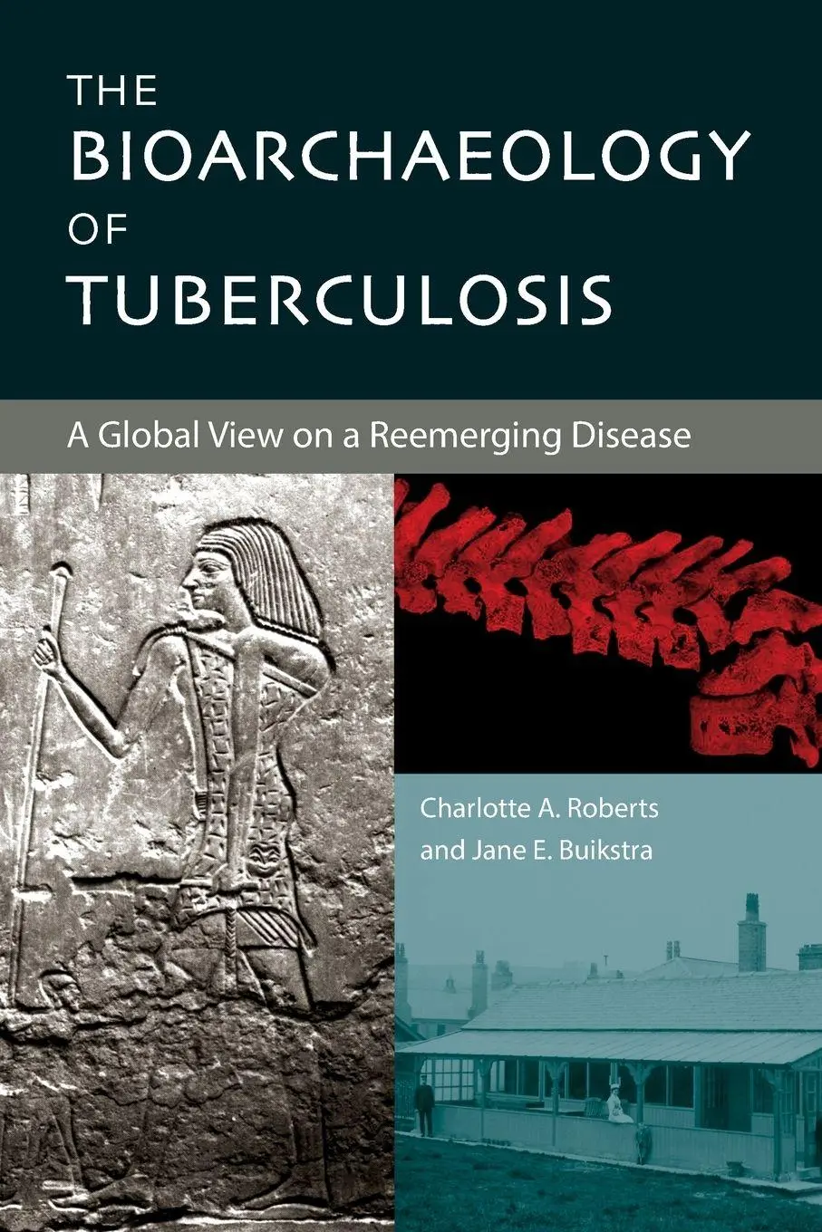 Cover: 9780813032696 | The Bioarchaeology of Tuberculosis | Charlotte A. Roberts (u. a.)