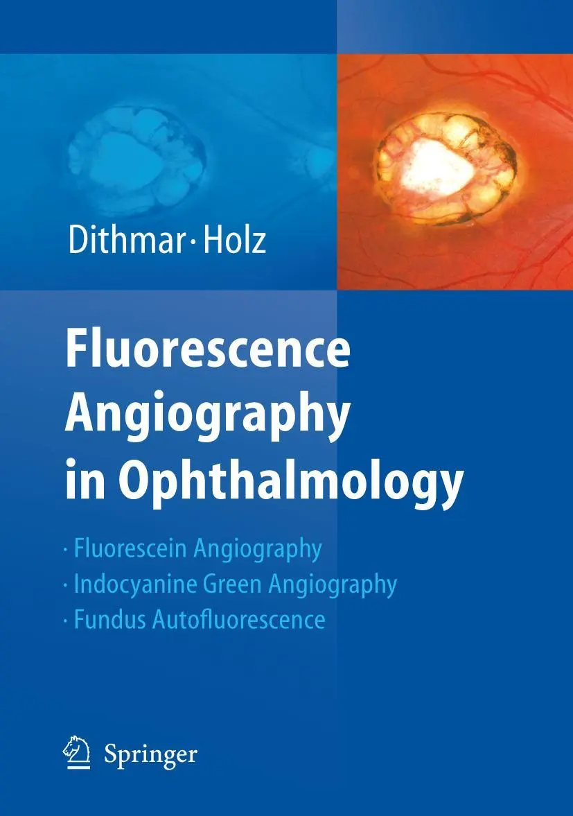 Cover: 9783540783596 | Fluorescence Angiography in Ophthalmology | Frank G. Holz (u. a.) | x