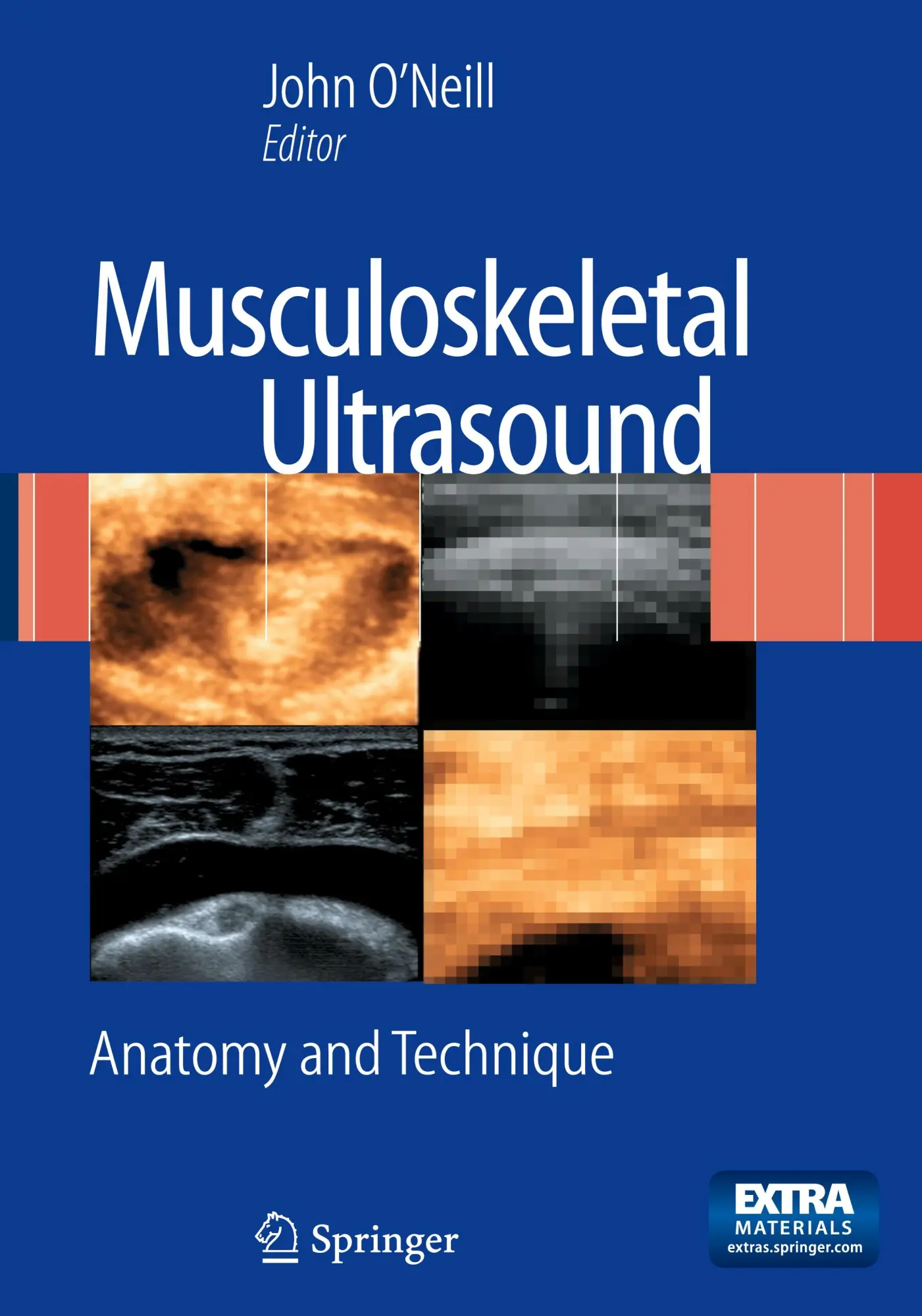 Cover: 9780387766096 | Musculoskeletal Ultrasound | Anatomy and Technique | O'Neill | Buch