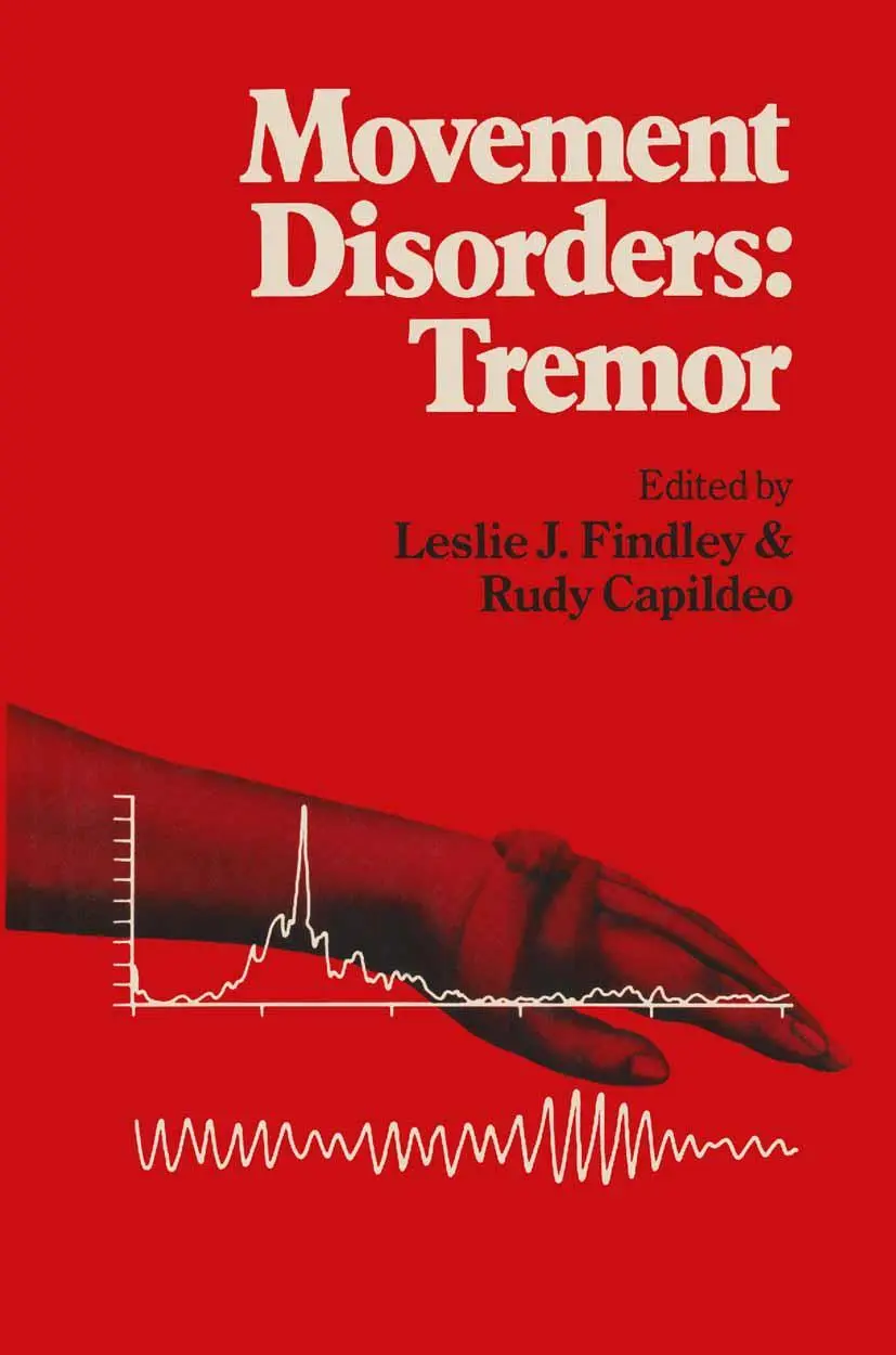 Cover: 9781349067596 | Movement Disorders: Tremor | Leslie J. Findley (u. a.) | Taschenbuch