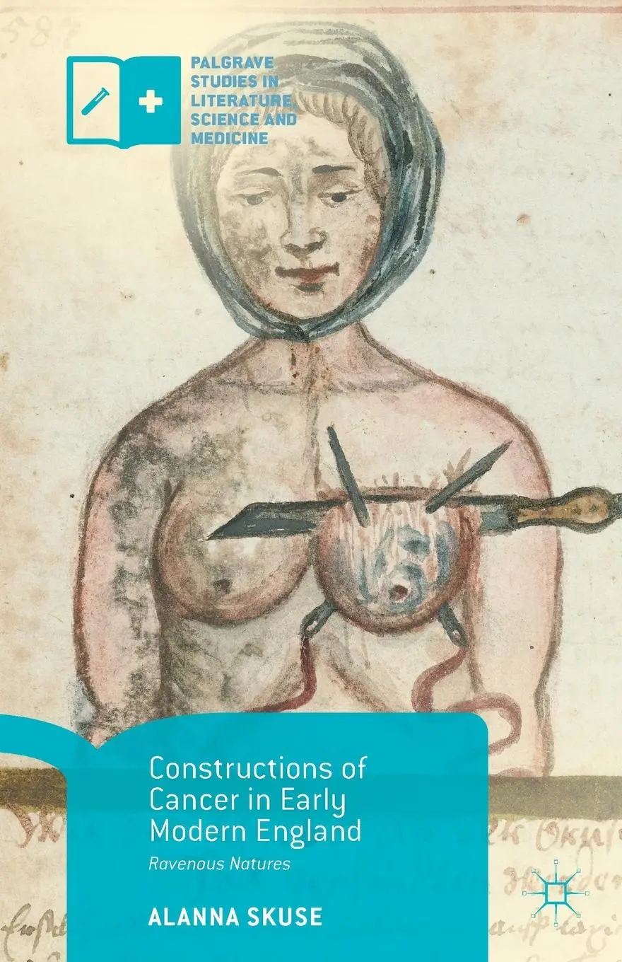 Cover: 9781137569196 | Constructions of Cancer in Early Modern England | Ravenous Natures