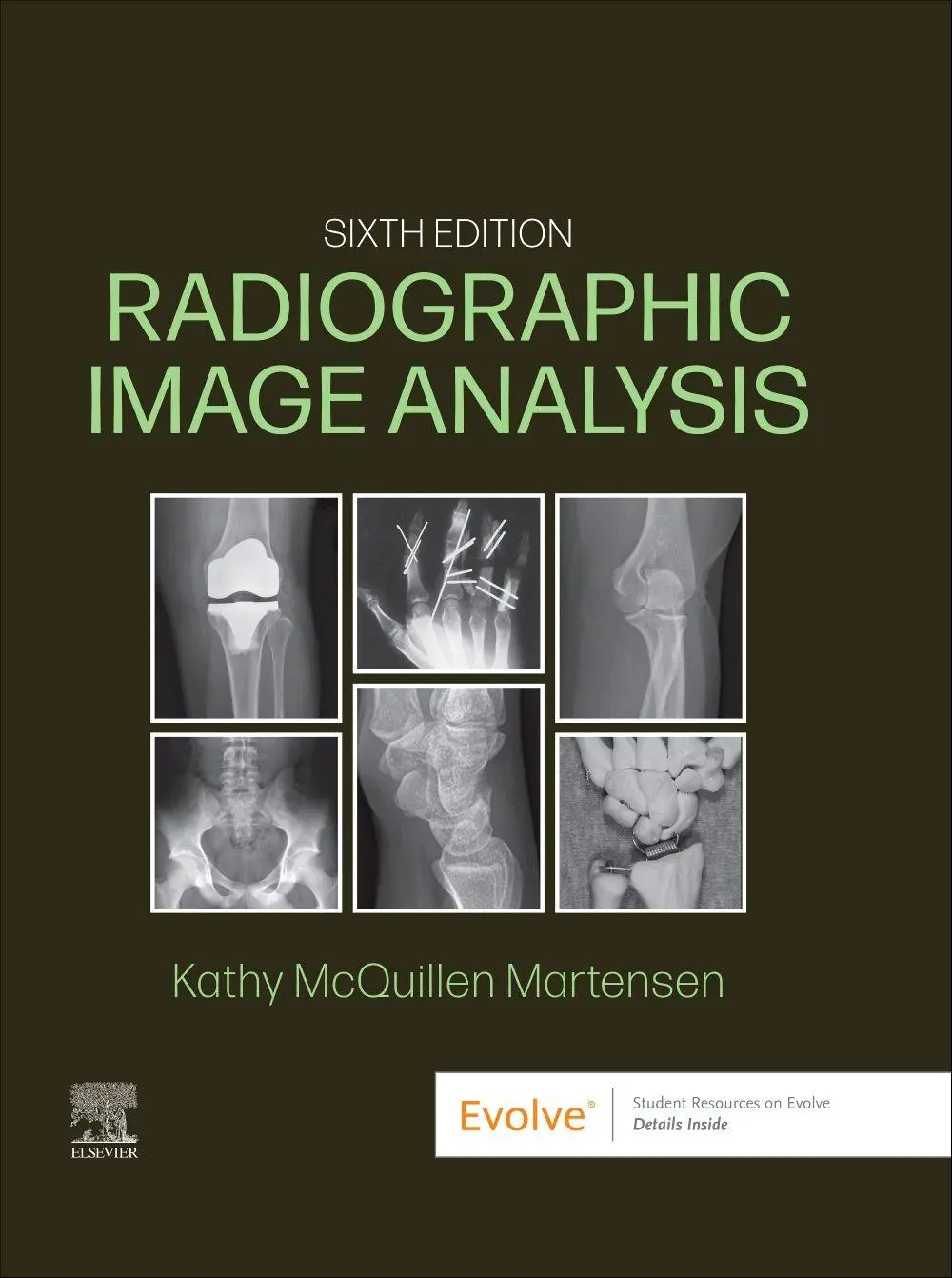 Cover: 9780323930697 | Radiographic Image Analysis | Kathy McQuillen Martensen | Buch | 2024
