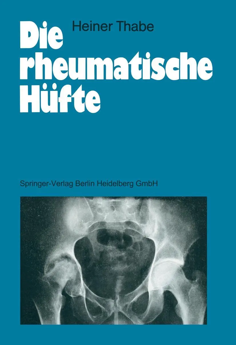 Cover: 9783540500797 | Die rheumatische Hüfte | Heiner Thabe | Taschenbuch | xiii | Deutsch