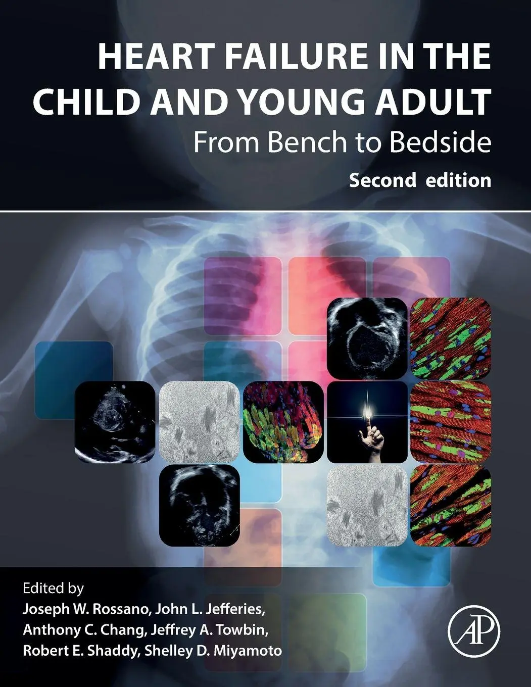 Heart Failure in the Child and Young Adult