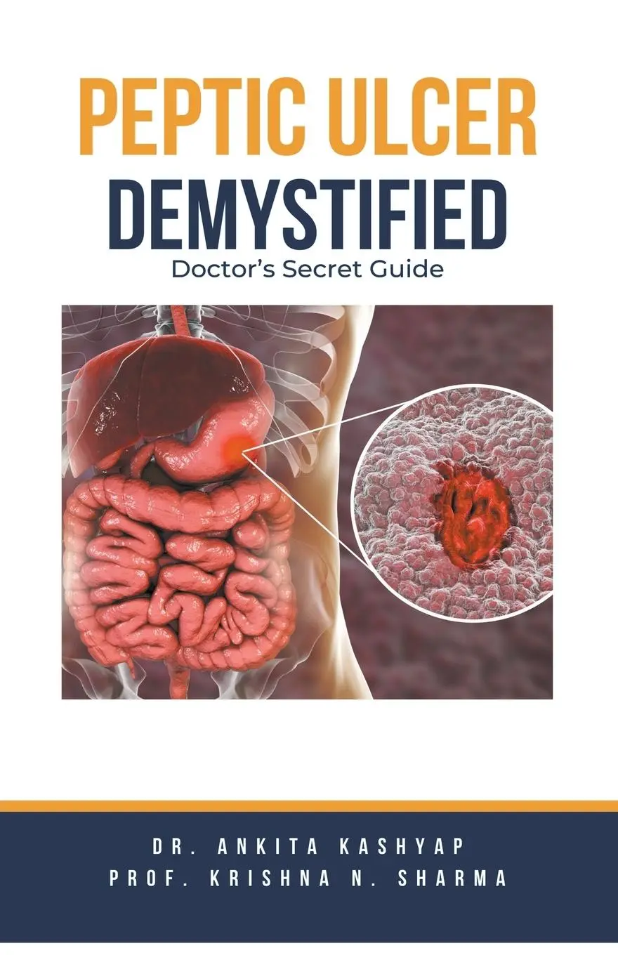 Cover: 9798223863397 | Peptic Ulcer Demystified | Doctor's Secret Guide | Kashyap (u. a.)