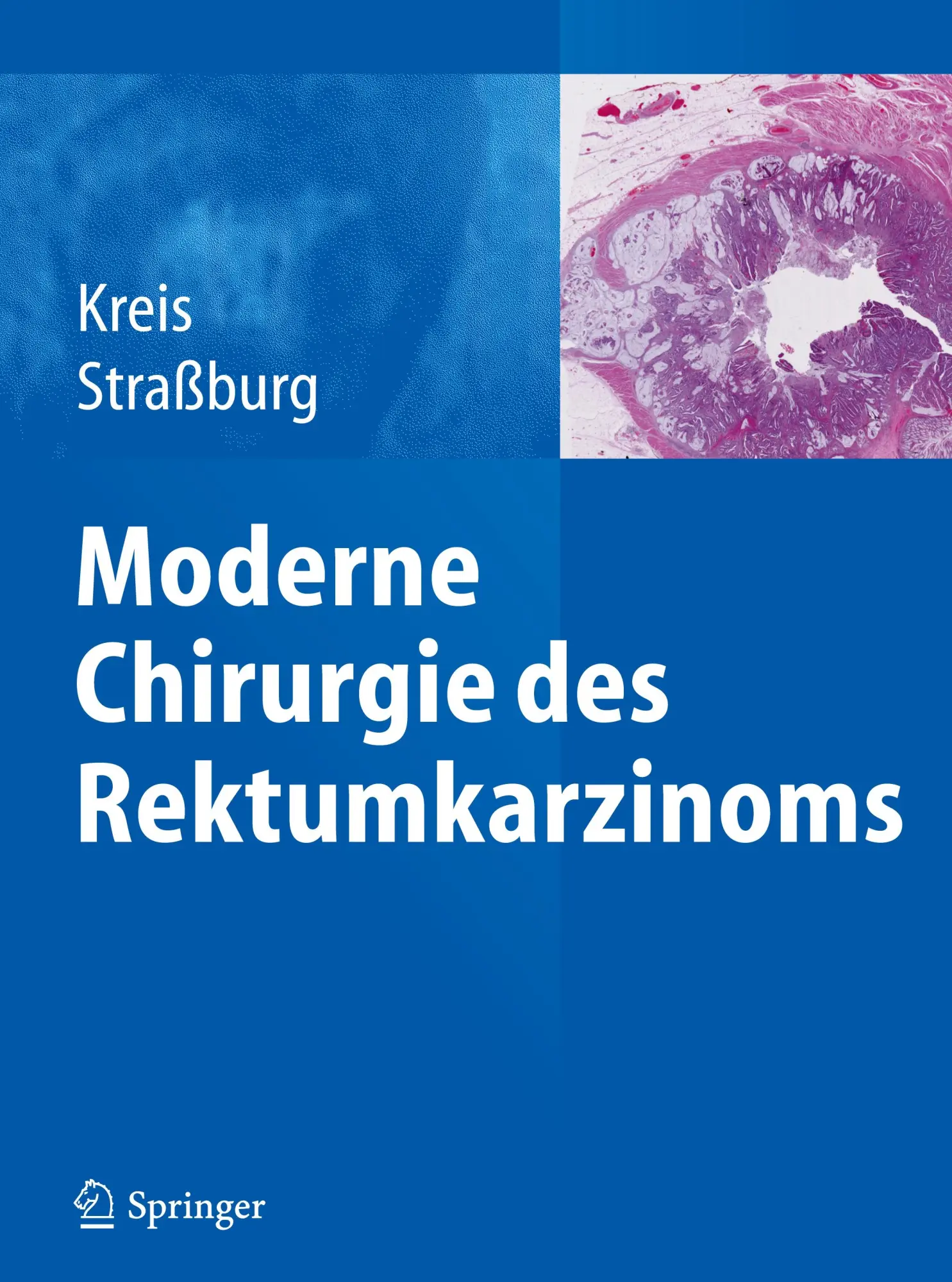 Cover: 9783642403897 | Moderne Chirurgie des Rektumkarzinoms | Joachim Straßburg (u. a.) | xi