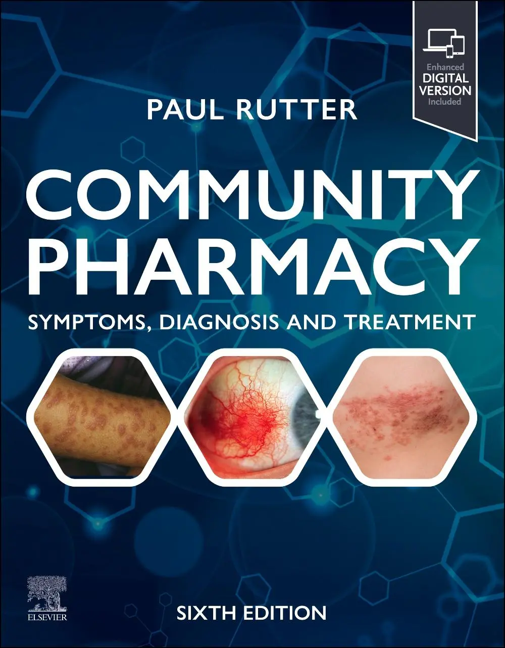 Cover: 9780443246197 | Community Pharmacy: Symptoms, Diagnosis and Treatment | Paul Rutter