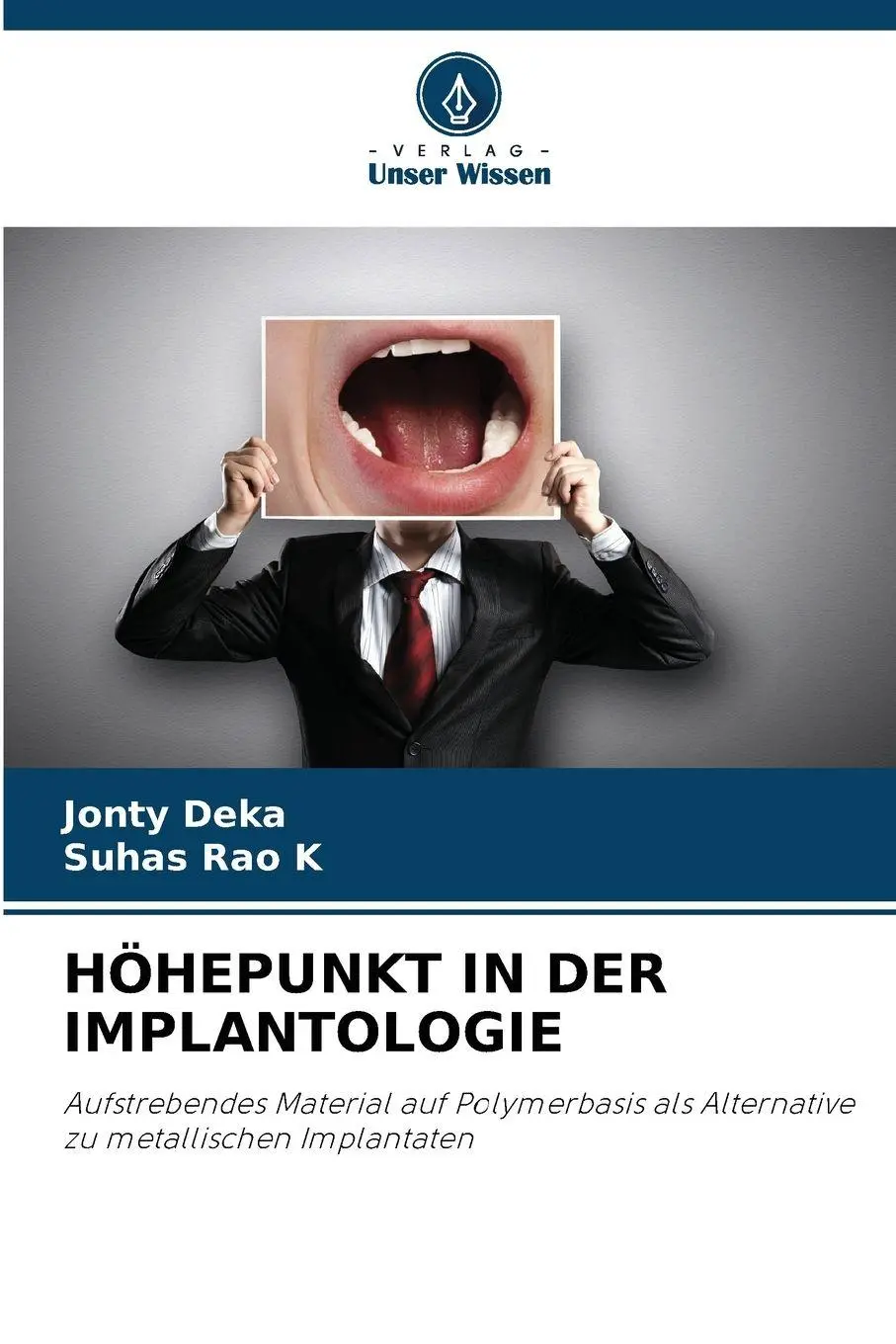 Cover: 9786136429397 | HÖHEPUNKT IN DER IMPLANTOLOGIE | Jonty Deka (u. a.) | Taschenbuch