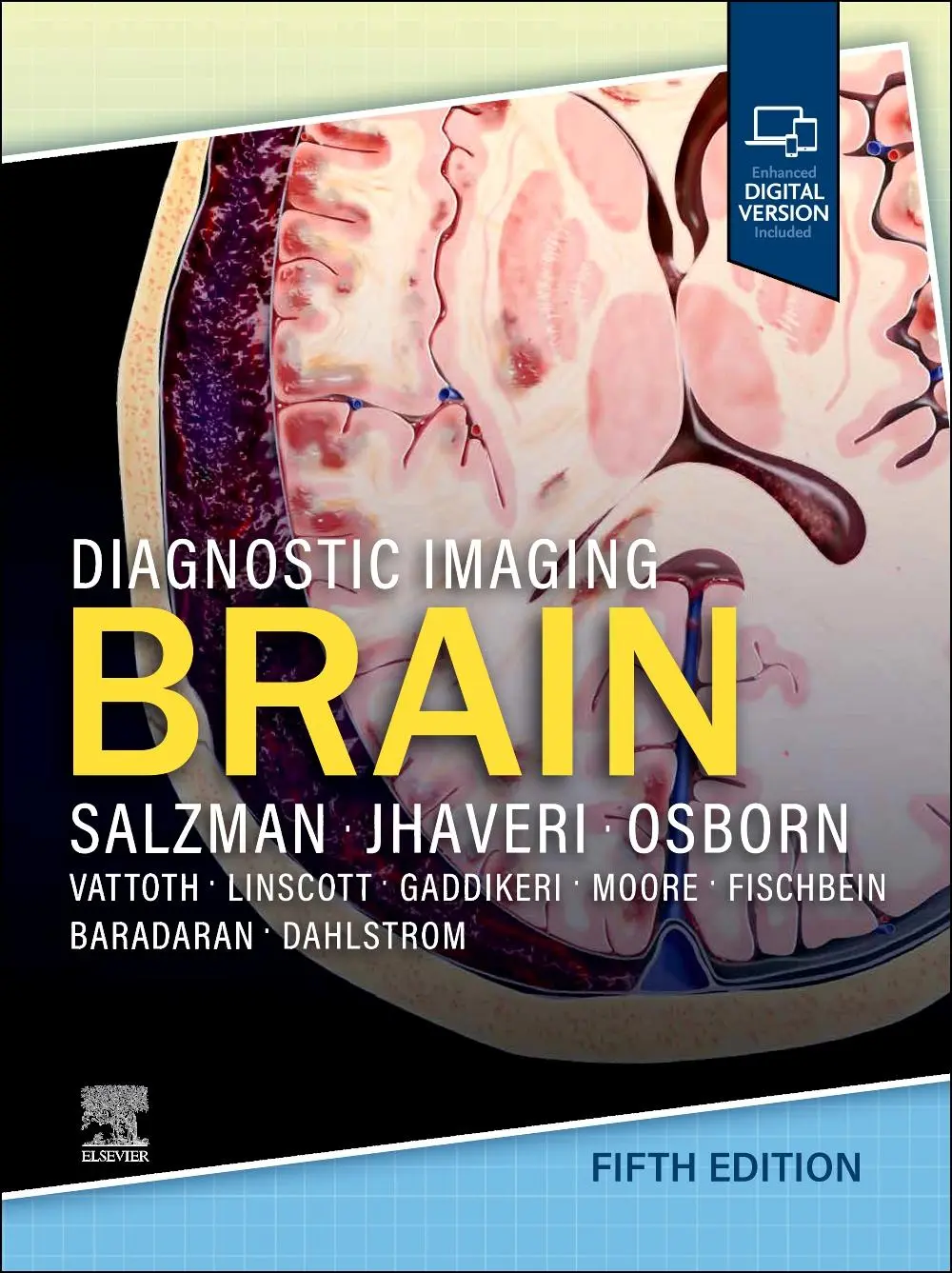 Cover: 9780443380198 | Diagnostic Imaging: Brain, | Karen L Salzman (u. a.) | Buch | Karte