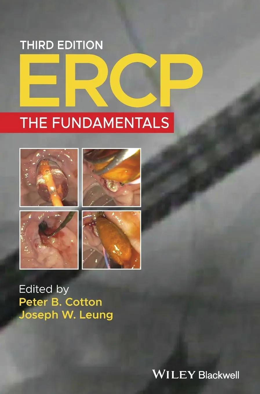 Cover: 9781119601098 | Ercp | The Fundamentals | Peter B Cotton (u. a.) | Buch | Gebunden