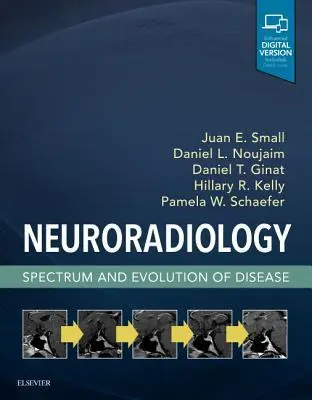Cover: 9780323445498 | Neuroradiology: Spectrum and Evolution of Disease | Small (u. a.)
