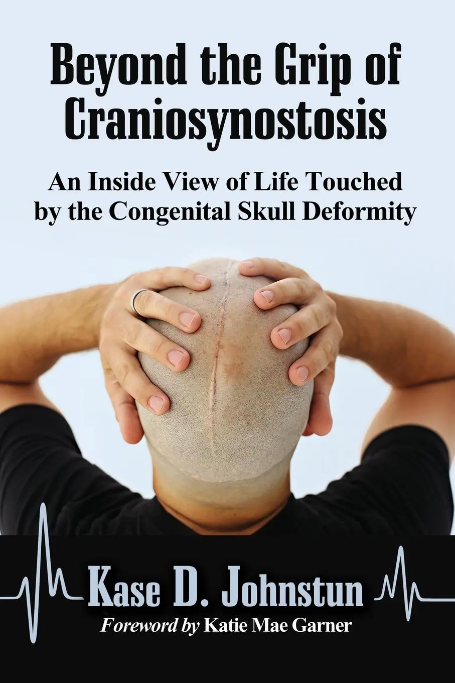 Cover: 9780786475698 | Beyond the Grip of Craniosynostosis | Kase D. Johnstun | Taschenbuch