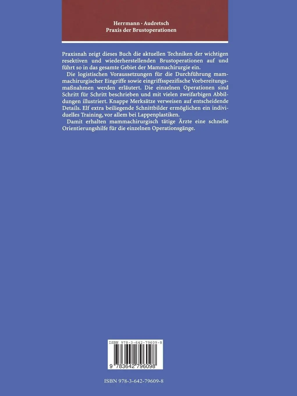 Rückseite: 9783642796098 | Praxis der Brustoperationen | Werner Audretsch (u. a.) | Taschenbuch