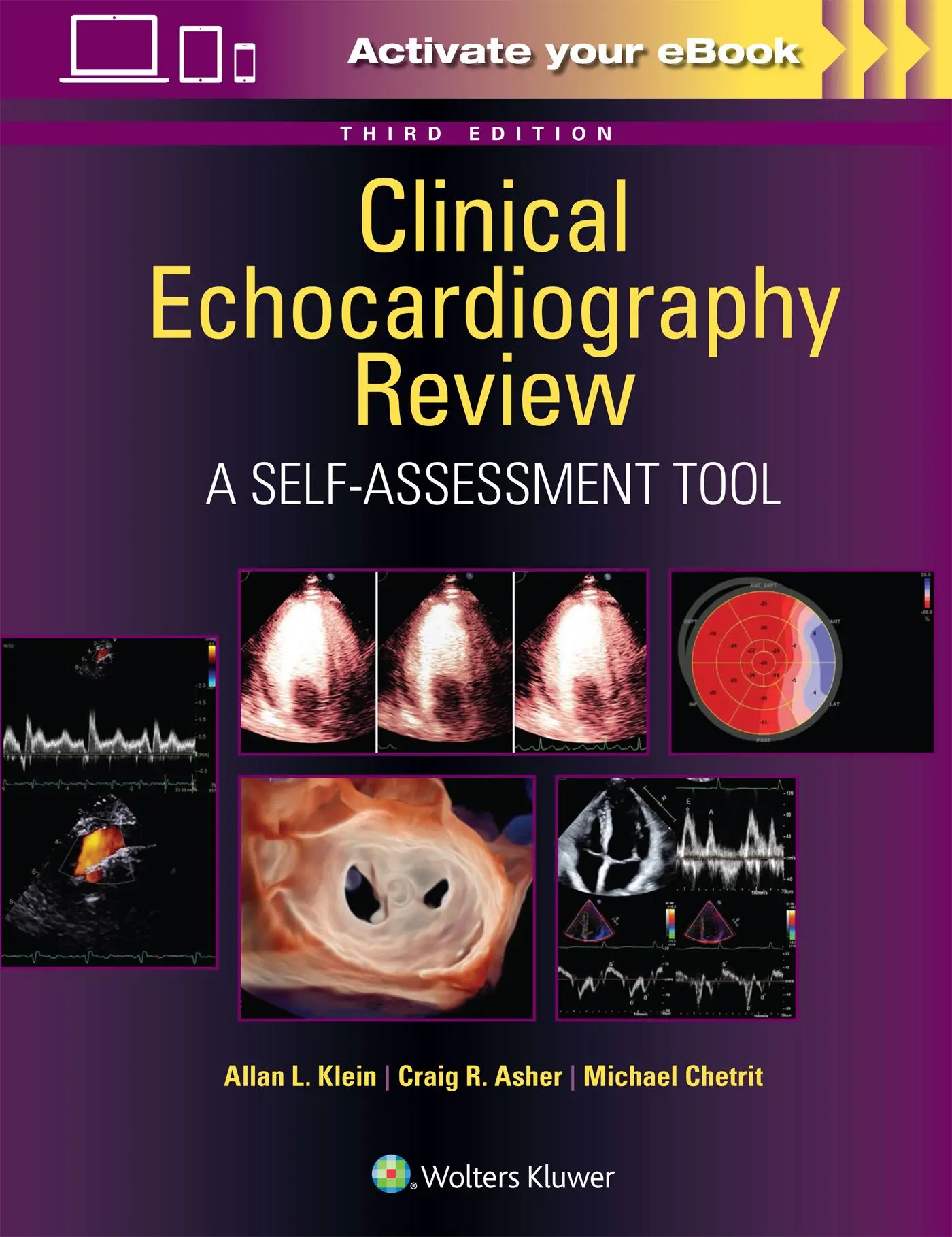 Cover: 9781975211899 | Clinical Echocardiography Review | Allan L Klein (u. a.) | Taschenbuch