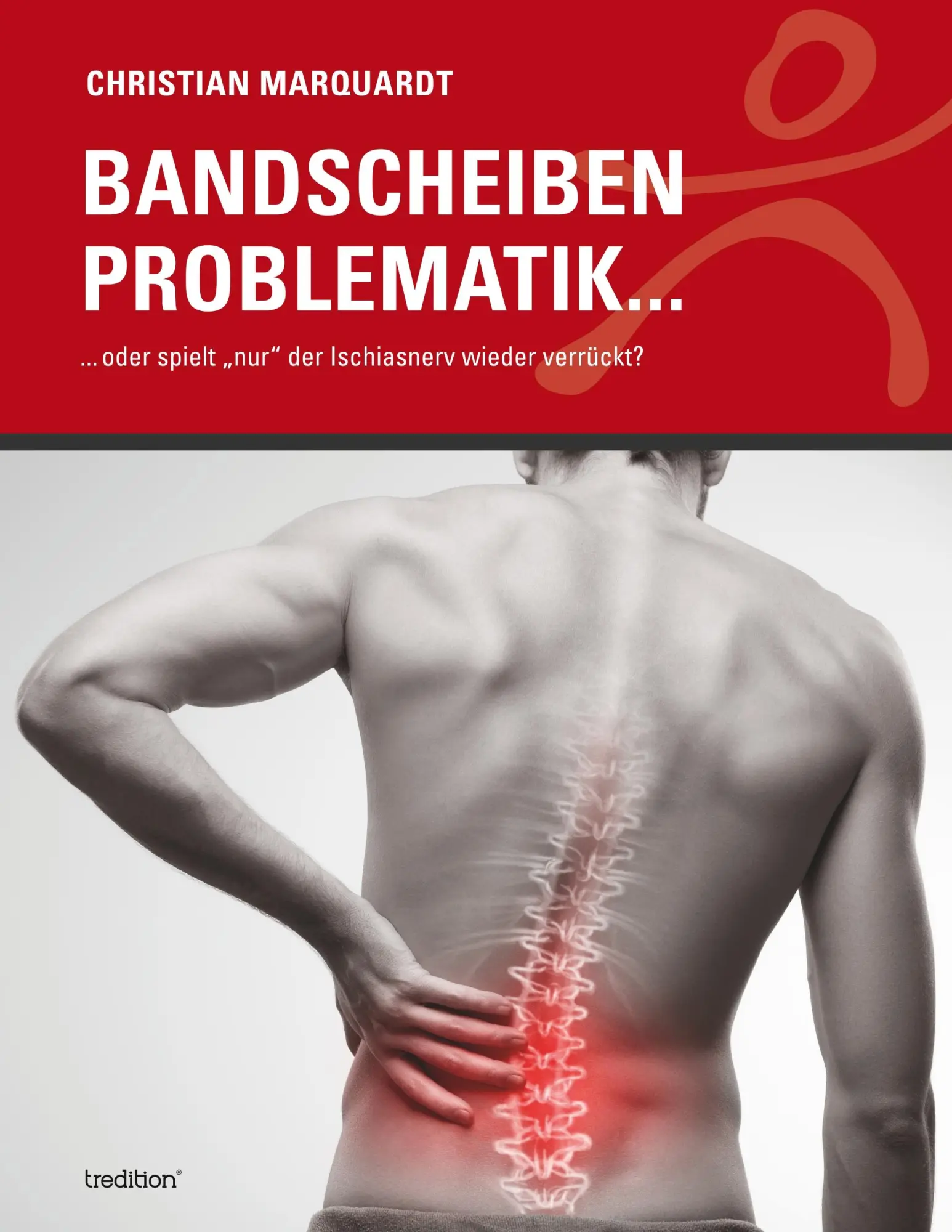 Cover: 9783748243199 | Bandscheiben Problematik | Christian Marquardt | Taschenbuch | 104 S.