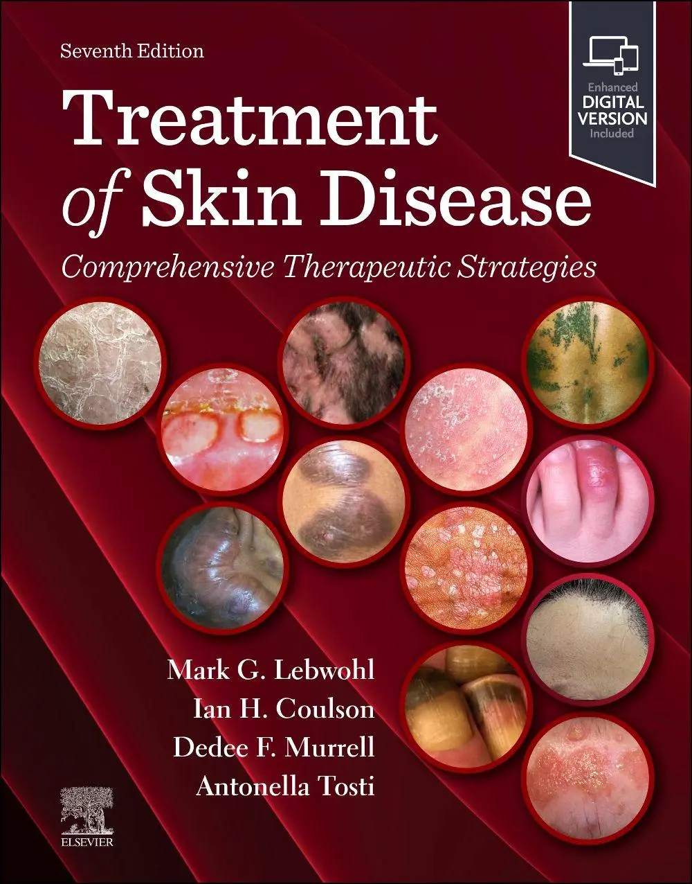 Cover: 9780443284199 | Treatment of Skin Disease | Comprehensive Therapeutic Strategies