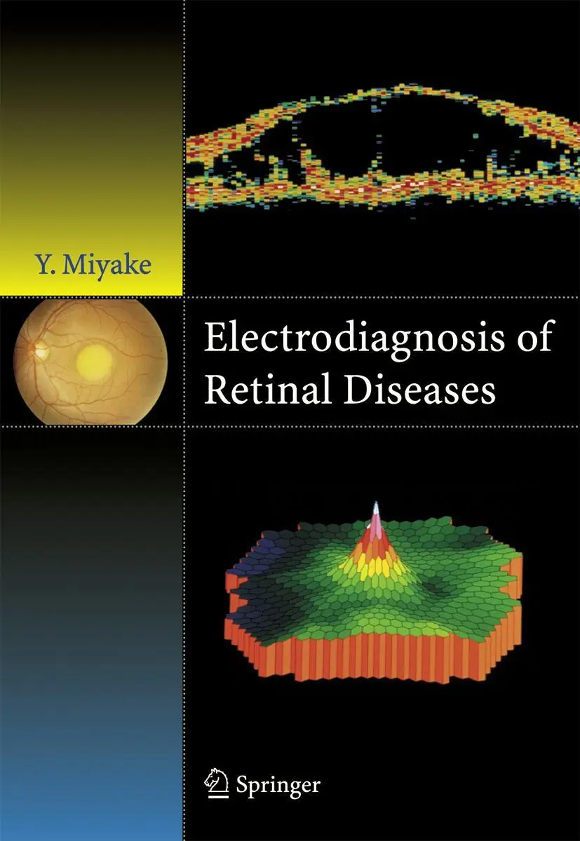 Cover: 9784431998099 | Electrodiagnosis of Retinal Disease | Yozo Miyake | Taschenbuch | x